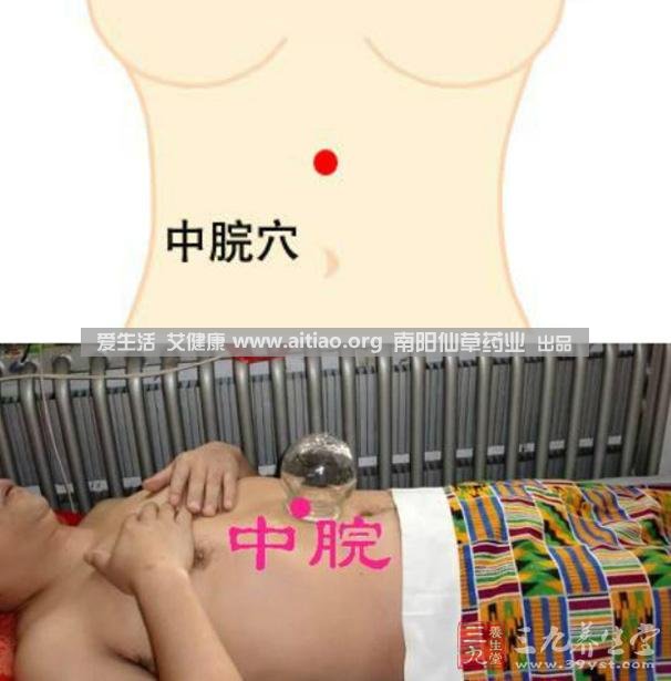中脘穴位于腹部正中線(xiàn)，臍上4寸的位置上。每天艾灸10-15分鐘，能有效緩解胃部不適的癥狀，同時(shí)有助于祛濕。