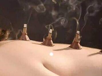 艾灸推拿等中醫養生保健八種技術(shù)規范發(fā)布